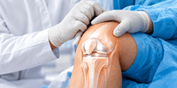 Knee Replacement